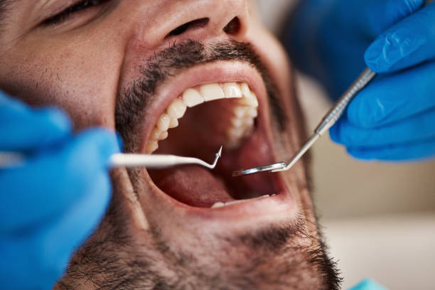 Best Broken or Chipped Tooth Repair in Keenesburg, CO